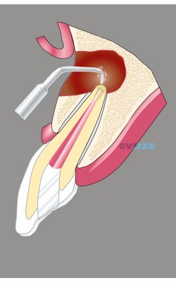 CHIRURGIE_3