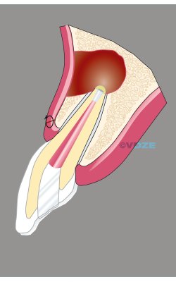 CHIRURGIE_4